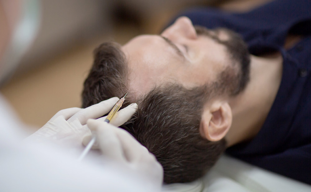 Healthy scalp care after hair transplant to support natural hair growth and restoration results
