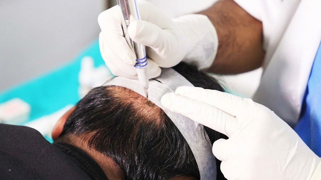 Specialist examining scalp health before a hair transplant consultation.