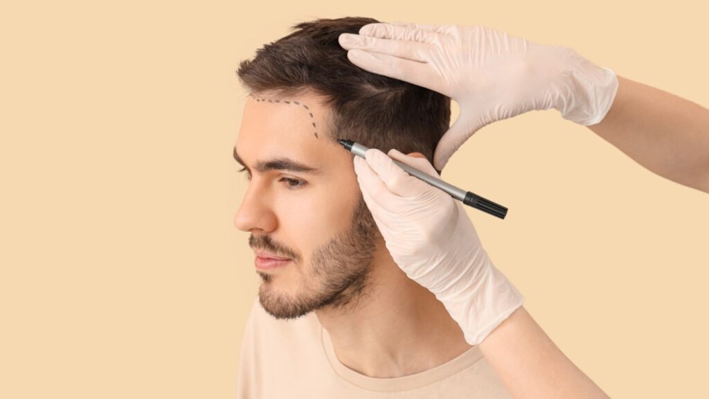 Young person consulting a hair specialist for early hair loss evaluation and treatment guidance.